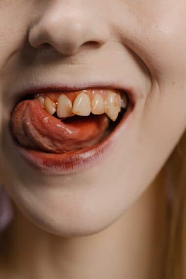 creer des dents de vampire